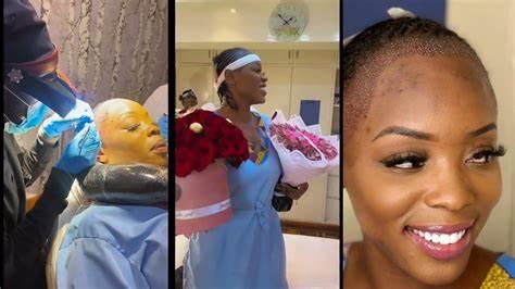 Risper Faith undergoes surgery to restore her receding hairline